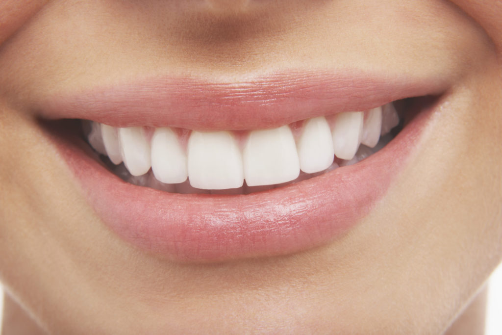 Woman smiling with white teeth