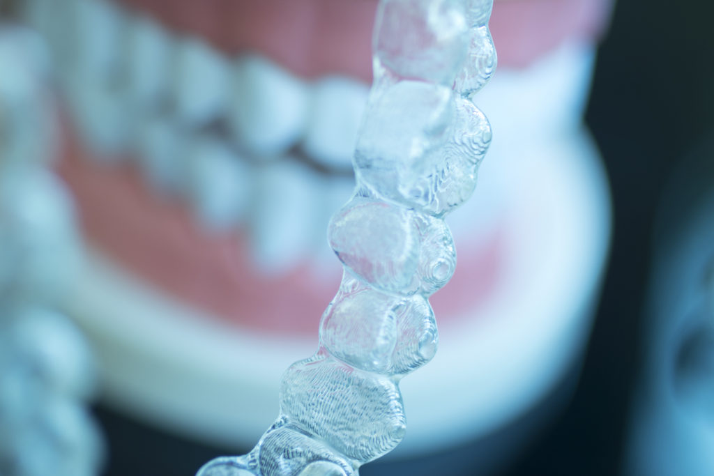 What Can Invisalign Fix Sunnyside Dental