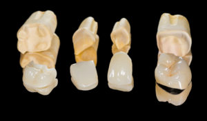 individual crowns for various teeth