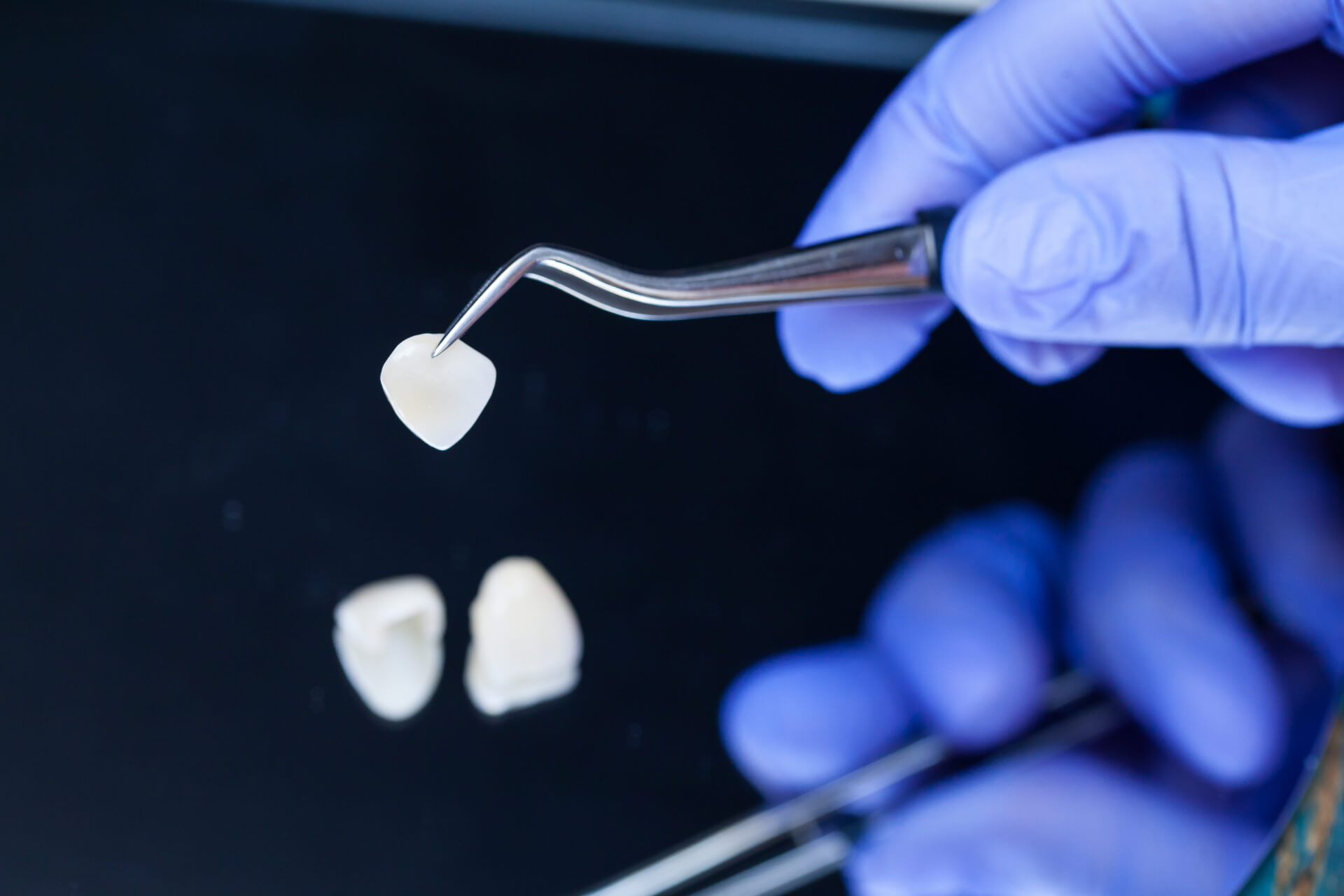 A dentist holding one of the many types of veneers